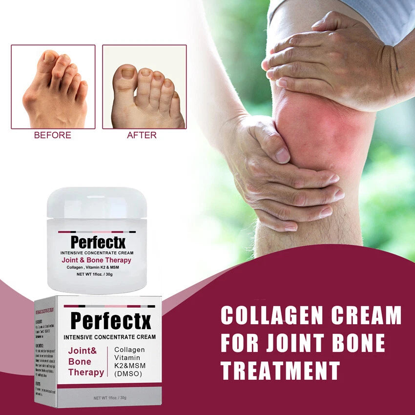 Collagen cream for joint bone treatment with 'Perfectx' branding, showing before and after effects on a person's knee.