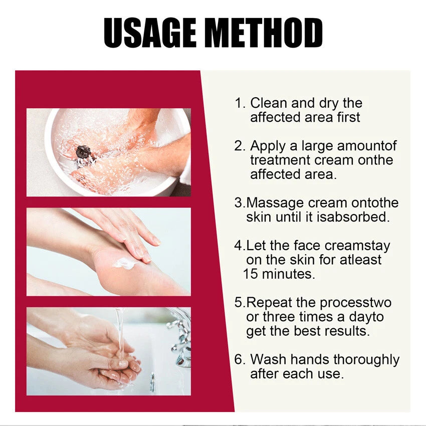 Instructions for using a treatment cream with images of hands applying and washing the cream.