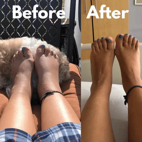 Pain Relief Compression Socks – Buy 1 Get 1 Free
