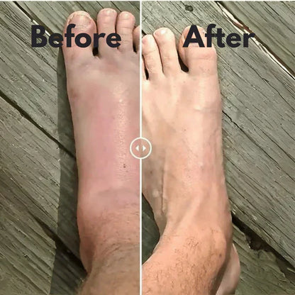 Pain Relief Compression Socks – Buy 1 Get 1 Free