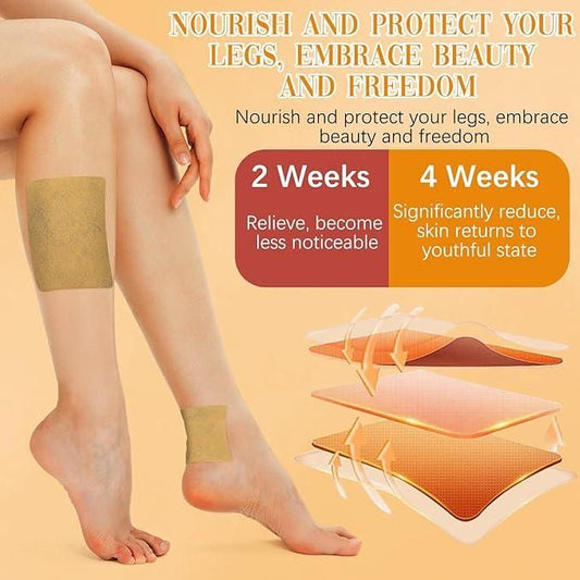 Turmeric Varicose Vein Relief Patches (Pack of 10)