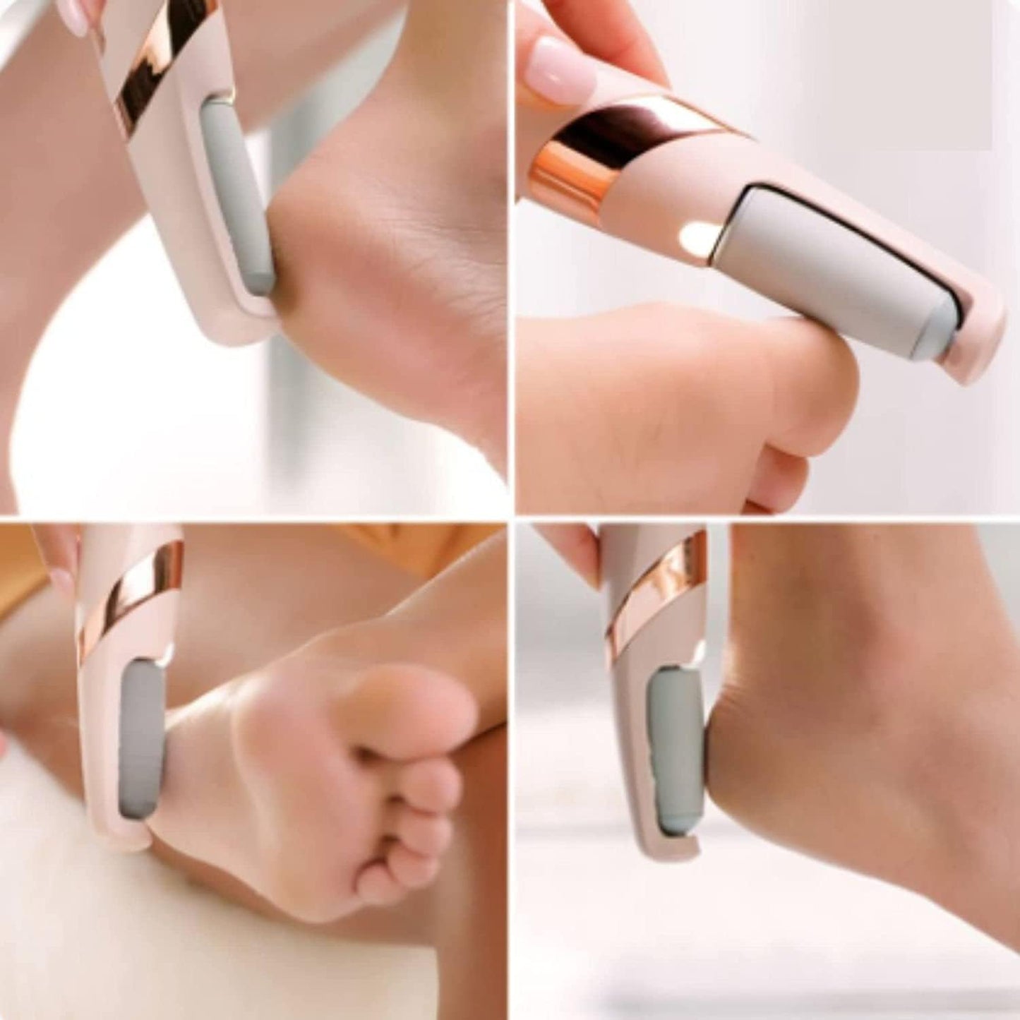 Alzaar PediPro™ | Electronic Foot File & Callus Remover