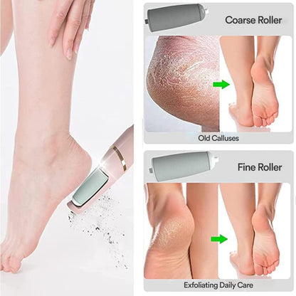 Alzaar PediPro™ | Electronic Foot File & Callus Remover