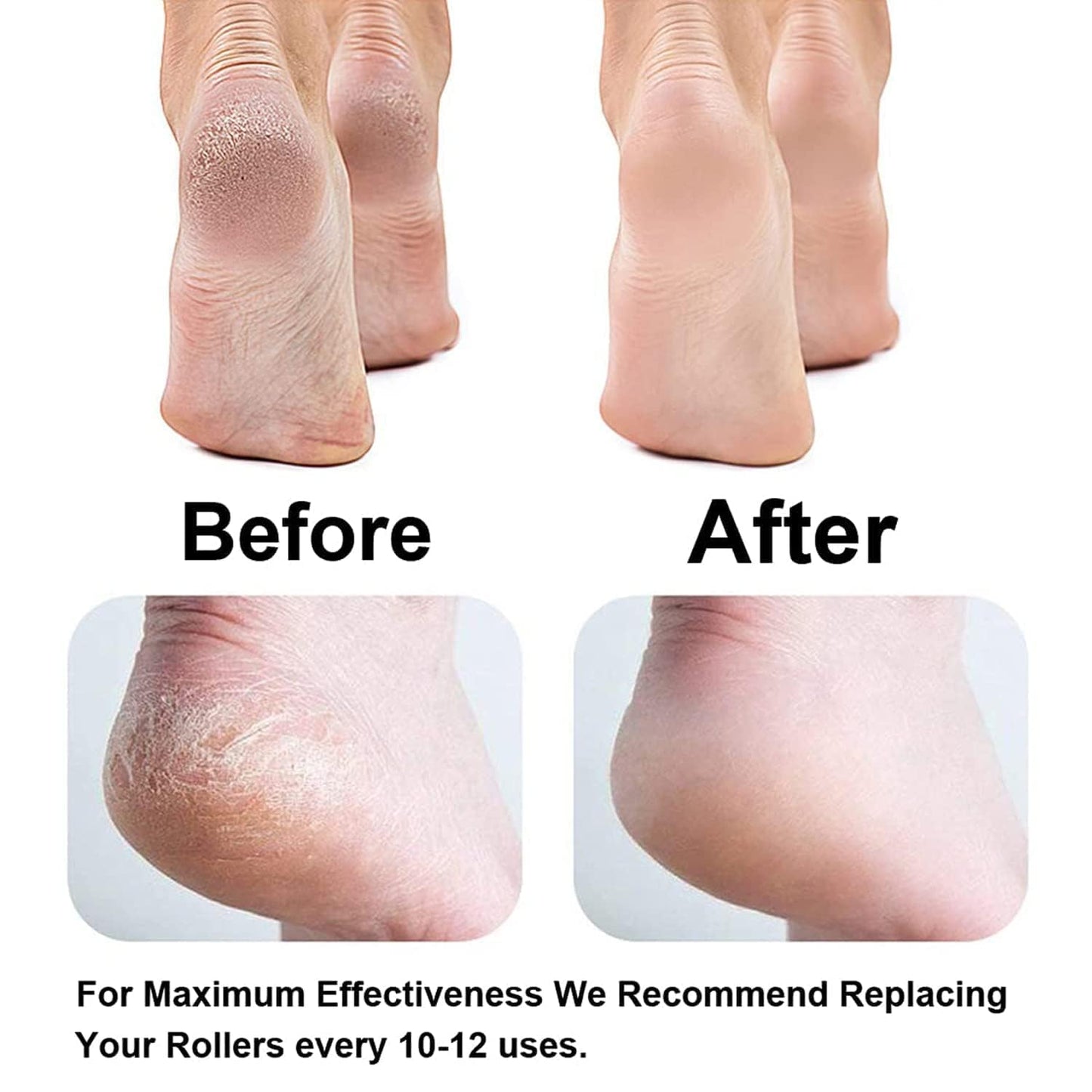 Alzaar PediPro™ | Electronic Foot File & Callus Remover