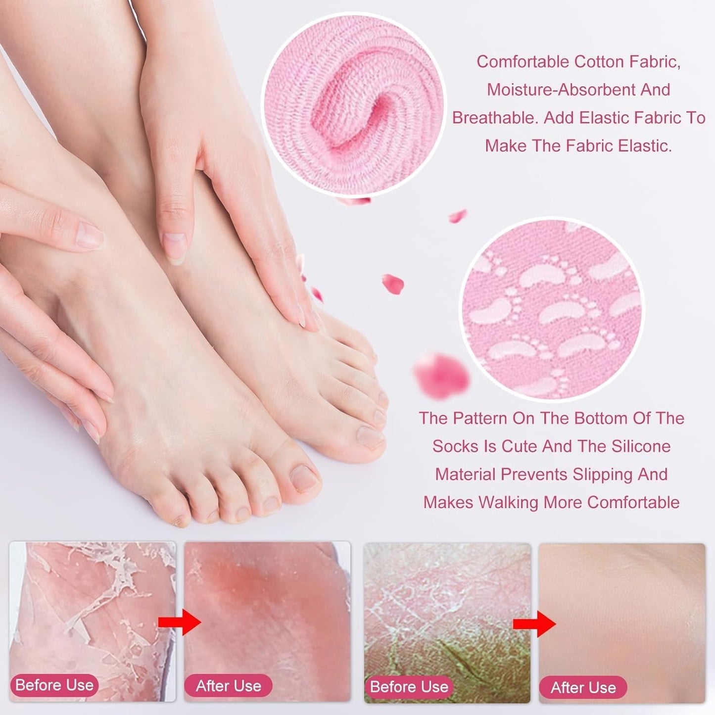 SpaFeet™ Socks for Cracked Heels – Moisturizing & Healing Foot Care for Soft, Smooth Skin