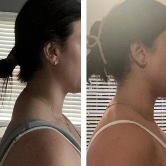 Neck and Shoulder Relaxer For Cervical Spine Alignment 6a4mhe-0u