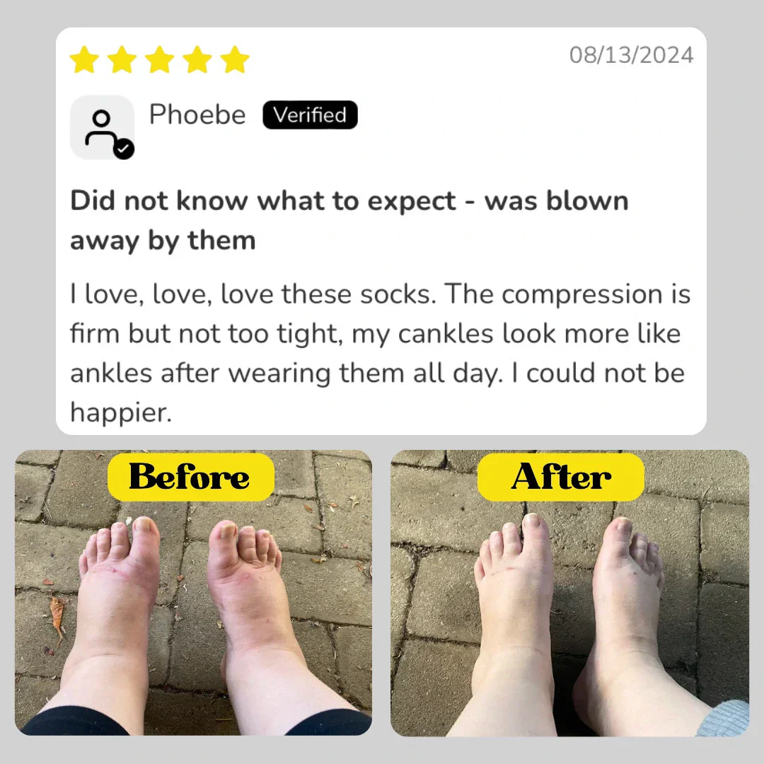 Pain Relief Compression Socks – Buy 1 Get 1 Free