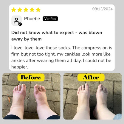 Pain Relief Compression Socks – Buy 1 Get 1 Free